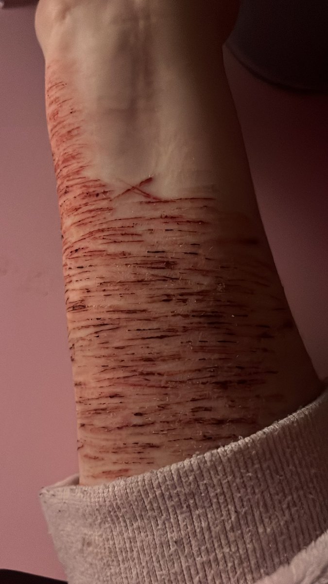 ᴢᴏᴍʙ🧟♂️ ʙᴇʀᴛ ᴏꜰ ᴇᴠɪʟᴛᴡᴛ tweet media