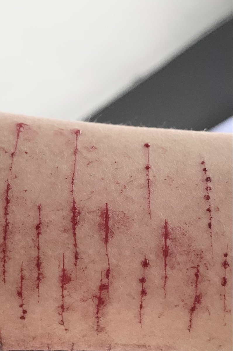 matenmeplix's tweet photo. #shtw https://t.co/DCzvvyQr7f