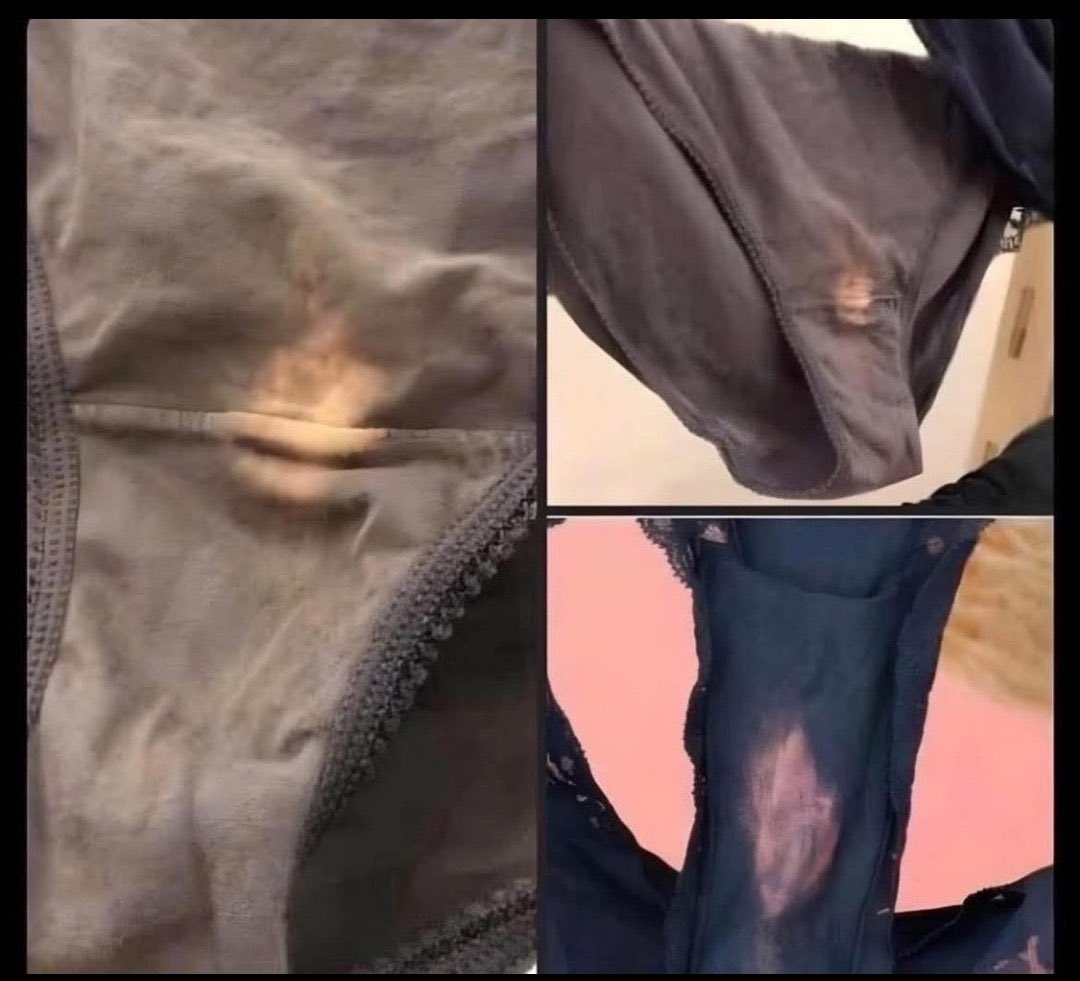 Please I saw this in my friend's house What can cause this ...