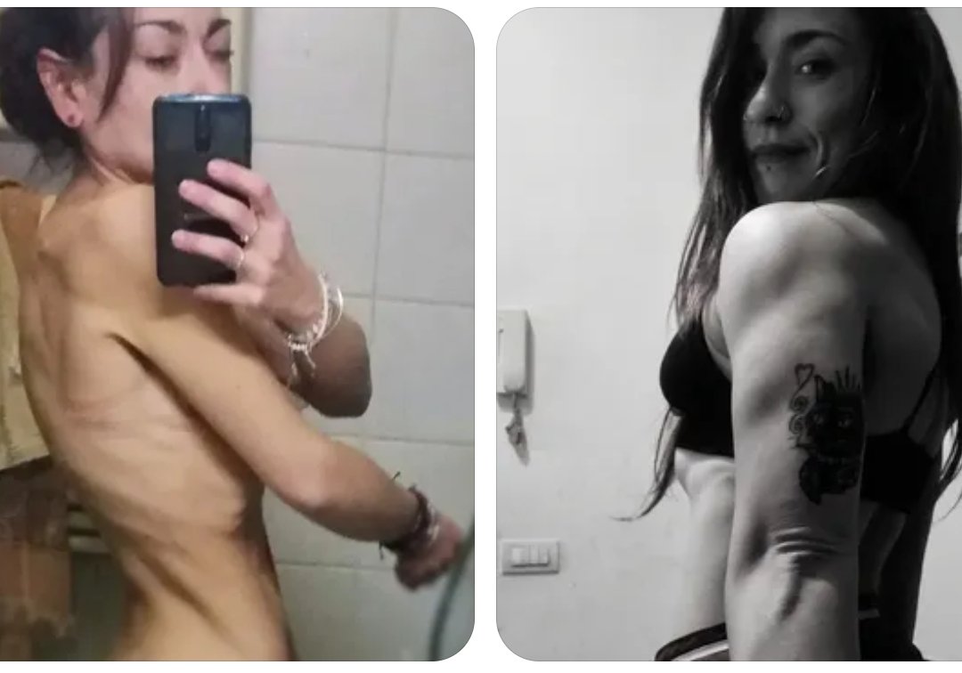 GLieto's tweet photo. Se stai combattendo contro un disturbo alimentare, voglio dirti un cosa semplice: un passo alla volta ce la farai.
Non arrenderti.
Cadrai spesso. Tornerai indietro tante volte.
Ma tu persisti. Non farti convincere che devi conviverci.

Io ci ho messo vent'anni. 

Insisti. https://t.co/IO1G0JchRk