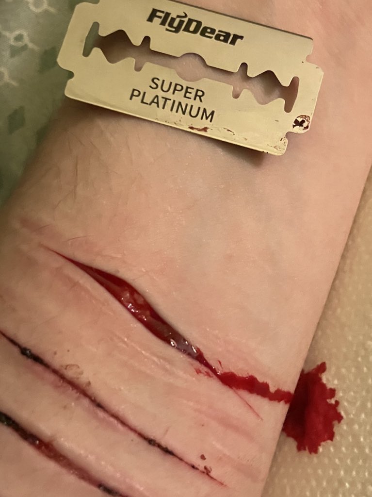 vynx_110's tweet photo. Reposts #sh #shtなりきりさんがrtしてくれてそれを見たshtなりきりさんがきっとフォローしてくれる #selfharm #shtwt #988twt #beans #styro #gore https://t.co/0dvYmGDyUW