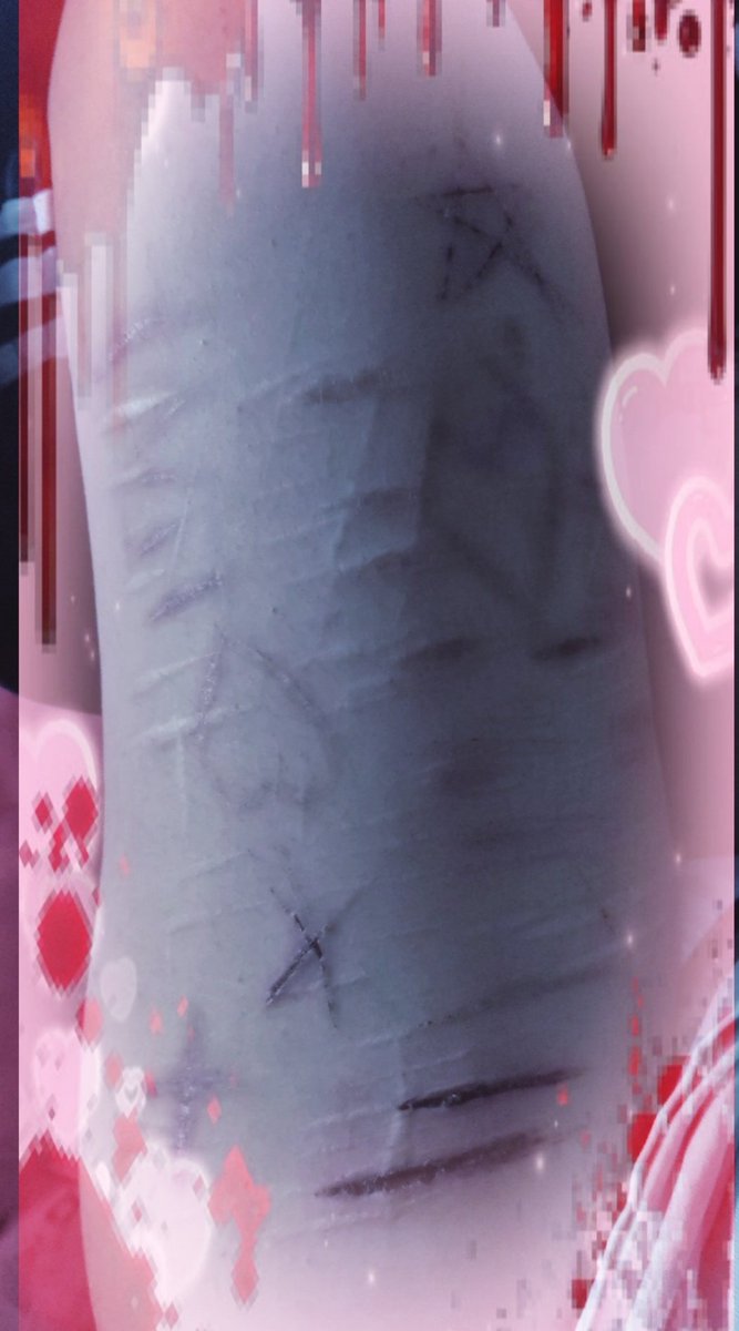 BxbYd3aD.⋆♱ tweet media