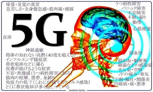 kazu_uracorona's tweet photo. 街路樹は、5Ｇの基地局（アンテナ）を立てるために伐採されています。

5Ｇは木があると電波が届かないからです。 https://t.co/7jGXvpIj81