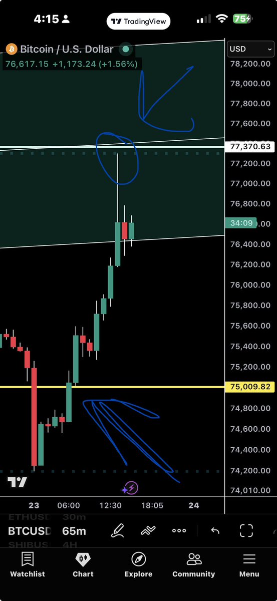 BurakTheScalper's tweet photo. After some spending time with my #babo and #kids #latenight #recap
Till then holla !!!!!
It is not over scoped that entry like always !!
#bitcoin #btc
#boom https://t.co/zBrZoEQorS