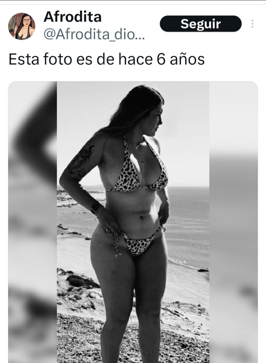 Chiccomigrain tweet media