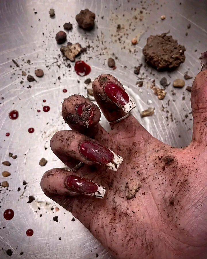 LordSalmonOnce's tweet photo. #CienciasForences
Las uñas revelan lo que el cuerpo sufrió en vida
IMÁGENES SENSIBLES https://t.co/FB2GIEhJmg