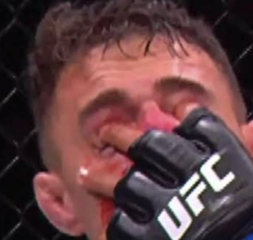 Juice MMA tweet media