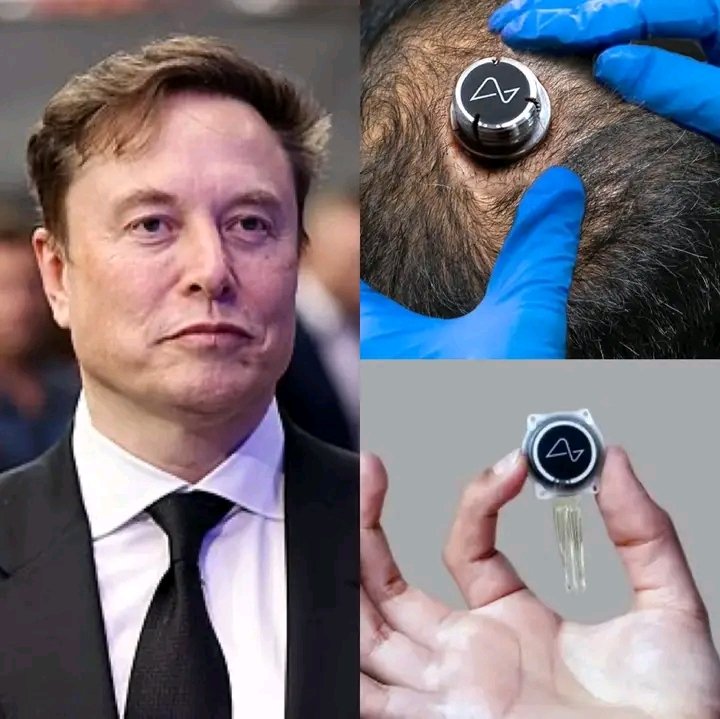 Gracetizzy's tweet photo. SCARY  Neuralink chip could help blind people see and deaf people hear… your brain literally starts working like a machine.
Some people are calling it the future, others think it’s getting too close to “playing God.
Real question… what are the side effects? @elonmusk https://t.co/sqjgfFMX8U