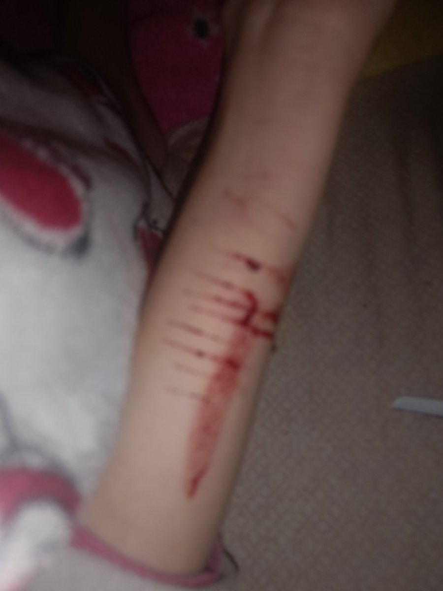 sweetsuicidalsh's tweet photo. you can hear me moaning 😺 #shtwt https://t.co/FGocJKpjTc
