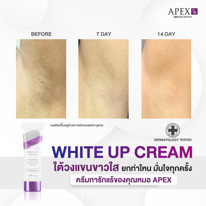 ck_kck07's tweet photo. ลองดู APEX-SX WHITE UP CREAM ครีมทารักแร้ขาว โดยแพทย์ผิวหนังเอเพ็กซ์ ทาขาหนีบดำ แก้มก้นดำ 50 ml. ในราคา ฿990 ที่ Shopee 
https://t.co/bng8VJtckD https://t.co/YLP7e2LzjW