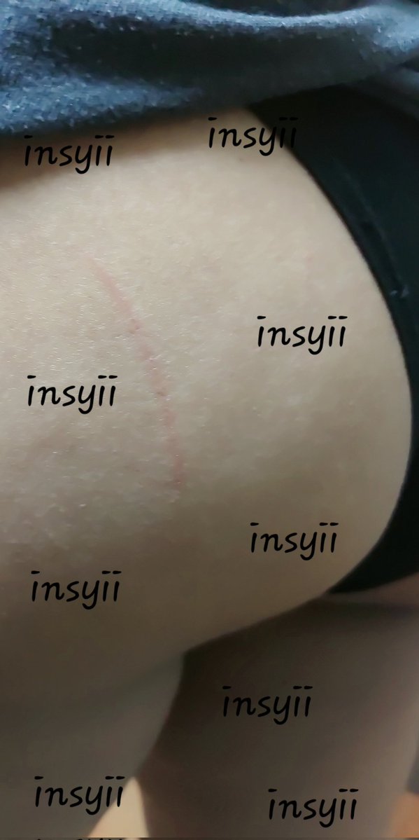 isyiii tweet media