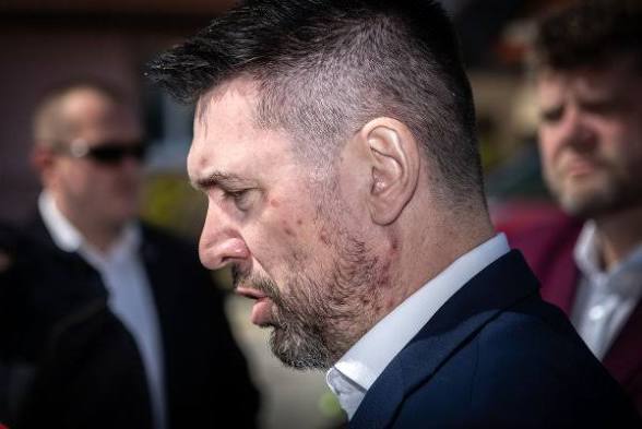 H3L3M3S3's tweet photo. Richard #Takac,slovensky ministr,bere drogy a je ve vlade,ktera chrani mafiany a zlodeje jako je Fico. Alkohol,tabak,kokain,cukr,uplatky,eurofondy..vsechno,na co si vzpomenete. Je to na nem i videt. https://t.co/1VhmYhWQ4c