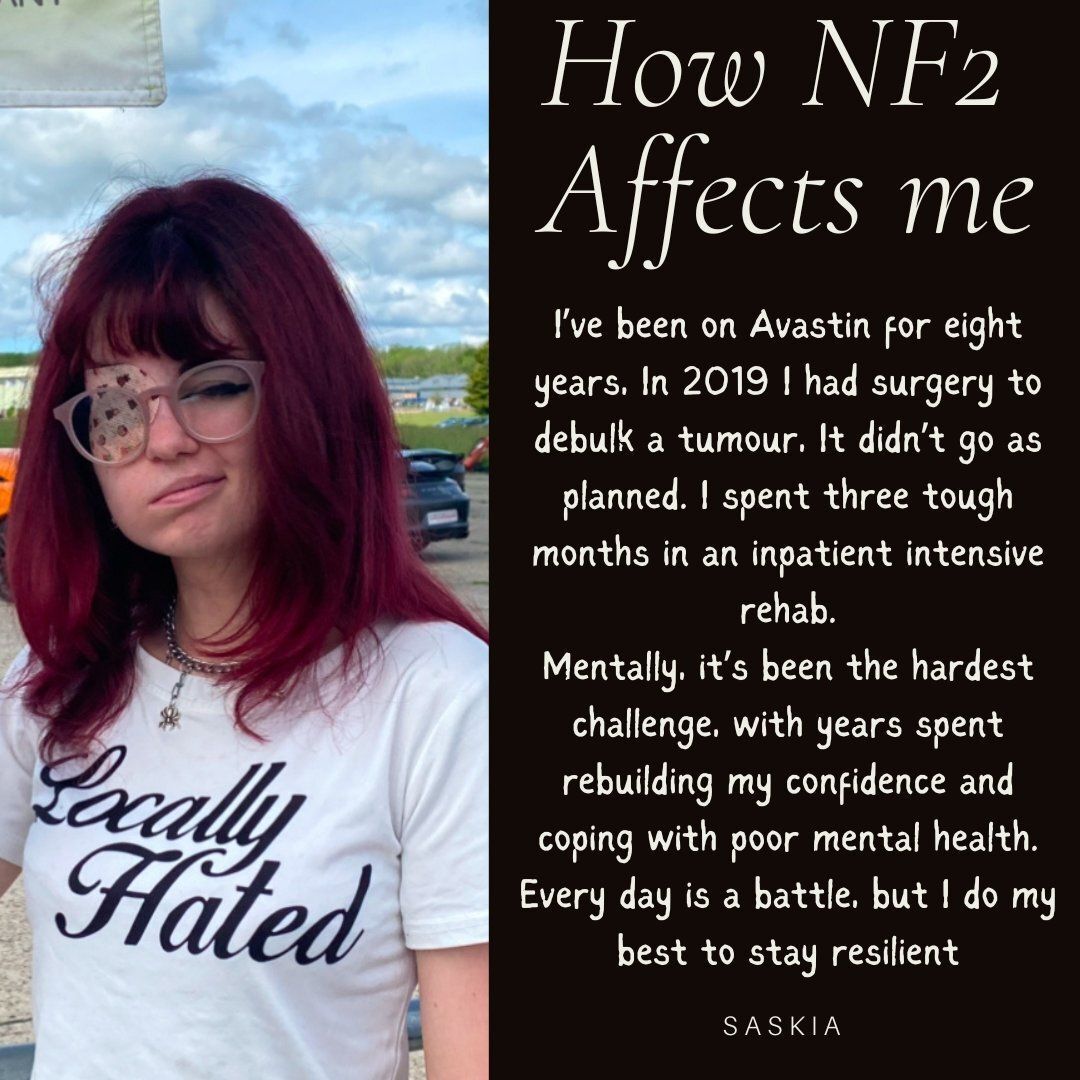 nf2biosolution1's tweet photo. We are still meeting those affected by NF2 highlighting their mental health and well being challenges.
We face a distinctive set of mental‑health and wellbeing challenges. NF2 significantly increases emotional strain, anxiety, depression &amp; stress
Today we meet Saskia 

#endNF2 https://t.co/PR4DCRohA9