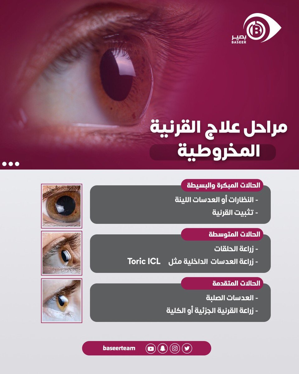 بصير tweet media
