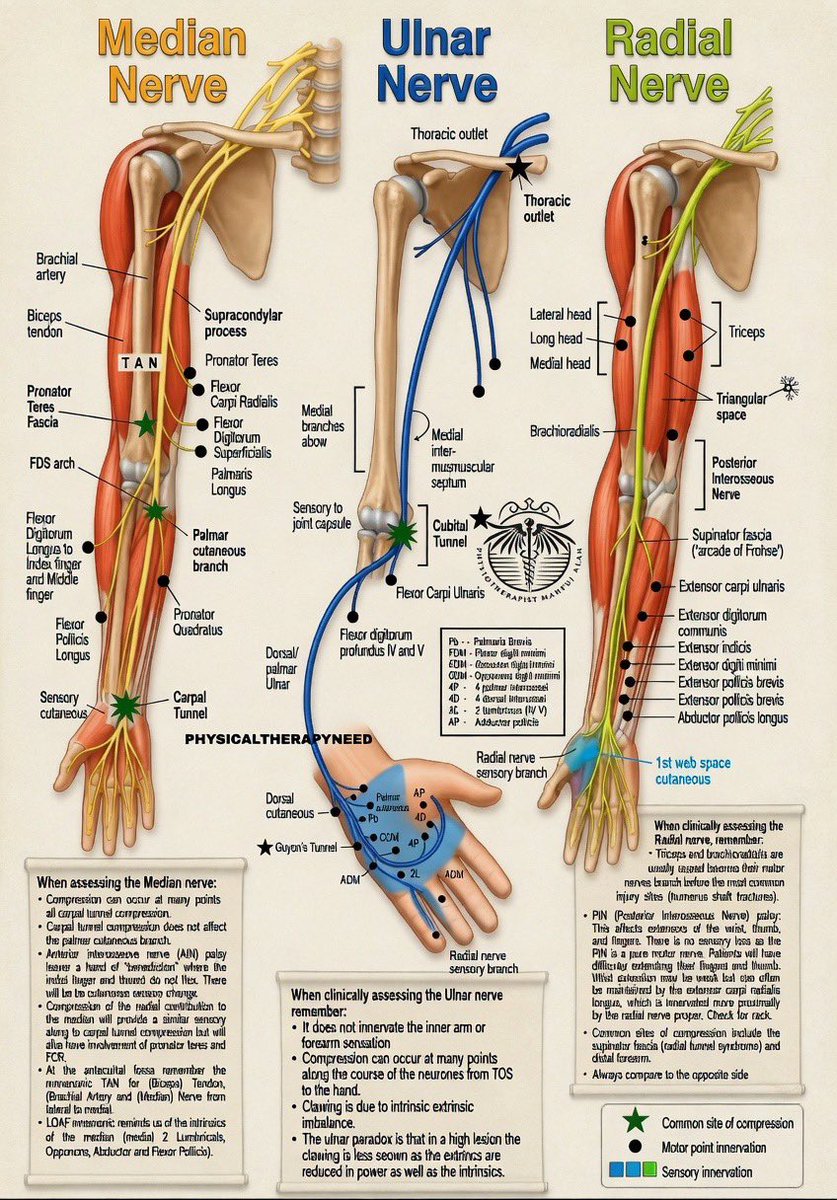 physio_clinics's tweet photo. 👨🏻‍⚕️ صورة طبية توضح الأعصاب الثلاثة الرئيسية في الذراع واليد 
1. العصب المتوسط (Median Nerve) - بالأصفر
•  يمر في منتصف الذراع.
•  يتحكم في حركة الإبهام والسبابة والوسطى، ويحسس باطن اليد.
•  أماكن الضغط الشائعة:
•  النفق الرسغي (Carpal Tunnel) ← أشهرها.
•  فوق الكوع (Pronator Teres).
•  إذا تأثر: صعوبة في قبض الأشياء + خدر في الأصابع الثلاثة الأولى.
2. العصب الزندي (Ulnar Nerve) - بالأزرق
•  يمر من الجانب الداخلي للذراع (منطقة “العظمة الطريفة”).
•  يتحكم في الخنصر والبنصر، ومعظم عضلات اليد الداخلية.
•  أماكن الضغط الشائعة:
•  خلف الكوع (Cubital Tunnel).
•  Guyon’s Tunnel في الرسغ.
•  إذا تأثر: “ claw hand” (تشوه مخلبي) + خدر في الخنصر والبنصر.
3. العصب الكعبري (Radial Nerve) - بالأخضر
•  يمر في الجانب الخارجي للذراع.
•  يتحكم في عضلات الذراع الخلفية (الترايسبس) وامتداد المعصم والأصابع.
•  أماكن الضغط الشائعة:
•  Spiral Groove في عظم العضد.
•  Arcade of Frohse في الساعد.
•  إذا تأثر: “Wrist drop” (سقوط المعصم) + صعوبة في رفع المعصم أو الأصابع.