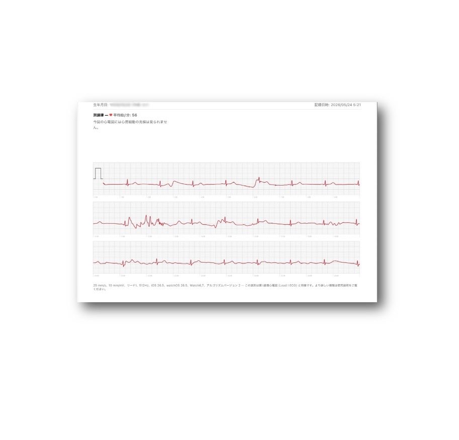 ヘルスケア 心電図 by Apple Watch 2026/5/24(日)5:21 洞調律 💓平均拍