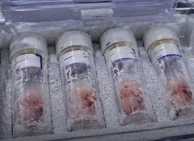 AfricanHub_'s tweet photo. An Israeli 🇮🇱 man was detained in Turkish Cyprus after authorities discovered a container with four human fetuses during a luggage inspection.

Reports say the embryos were stored in a specialized cooling device inside his bag. A court in Nicosia has ordered the suspect to remain in custody as investigations continue. 

He faces charges for transporting human tissue without the required permits.