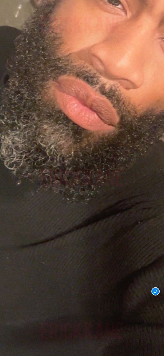 Erickkanexxx tweet media