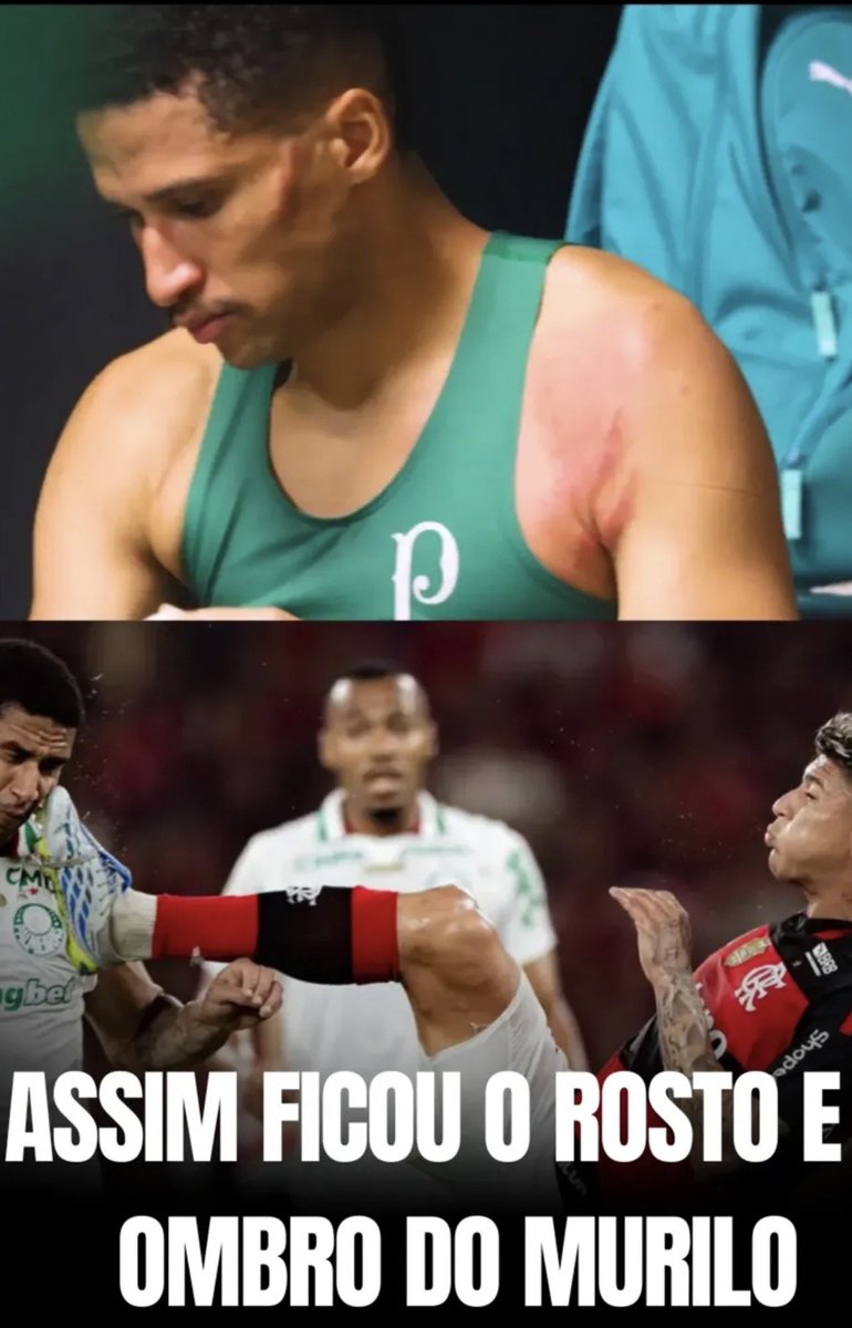 GaribaTDF's tweet photo. @RMPoficial Kkkkkkkkkkk https://t.co/zcO2SsrdxF