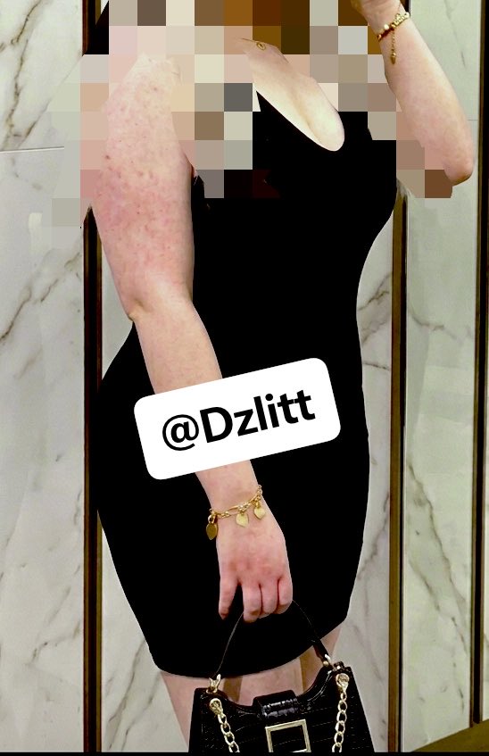 dzlitt tweet media