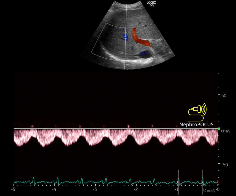 NephroPOCUS tweet media