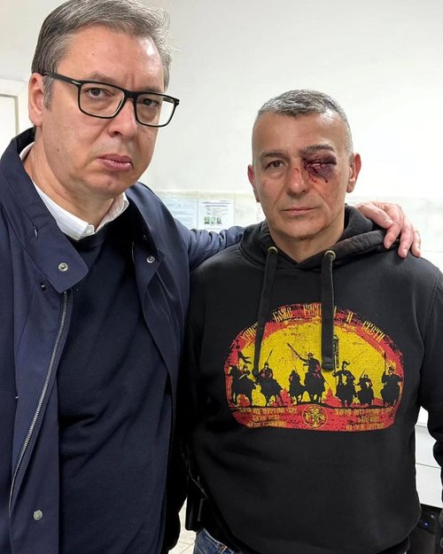 Bob Durlić ☮️ tweet media