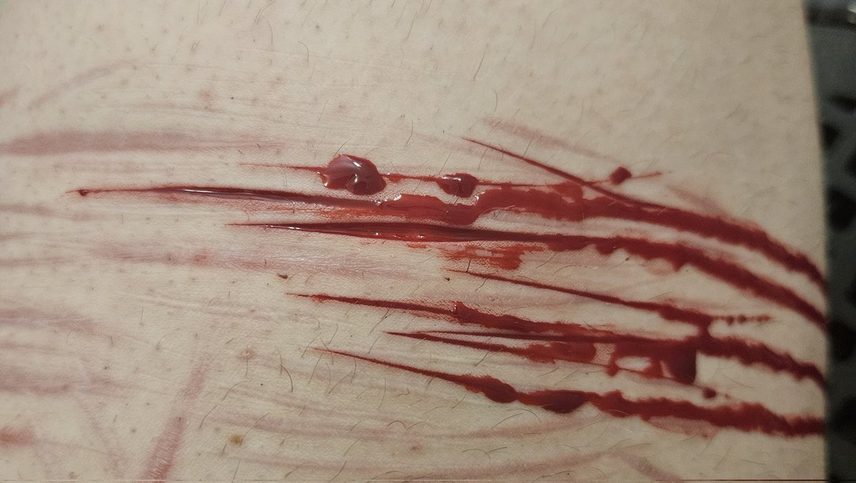 burntmillipede's tweet photo. Drunk sesh again https://t.co/8b4ZCkoF2B