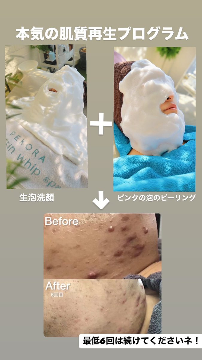 hilot283's tweet photo. 肌が爆誕するプログラムが大人気です！ https://t.co/Bwko2D4jdy