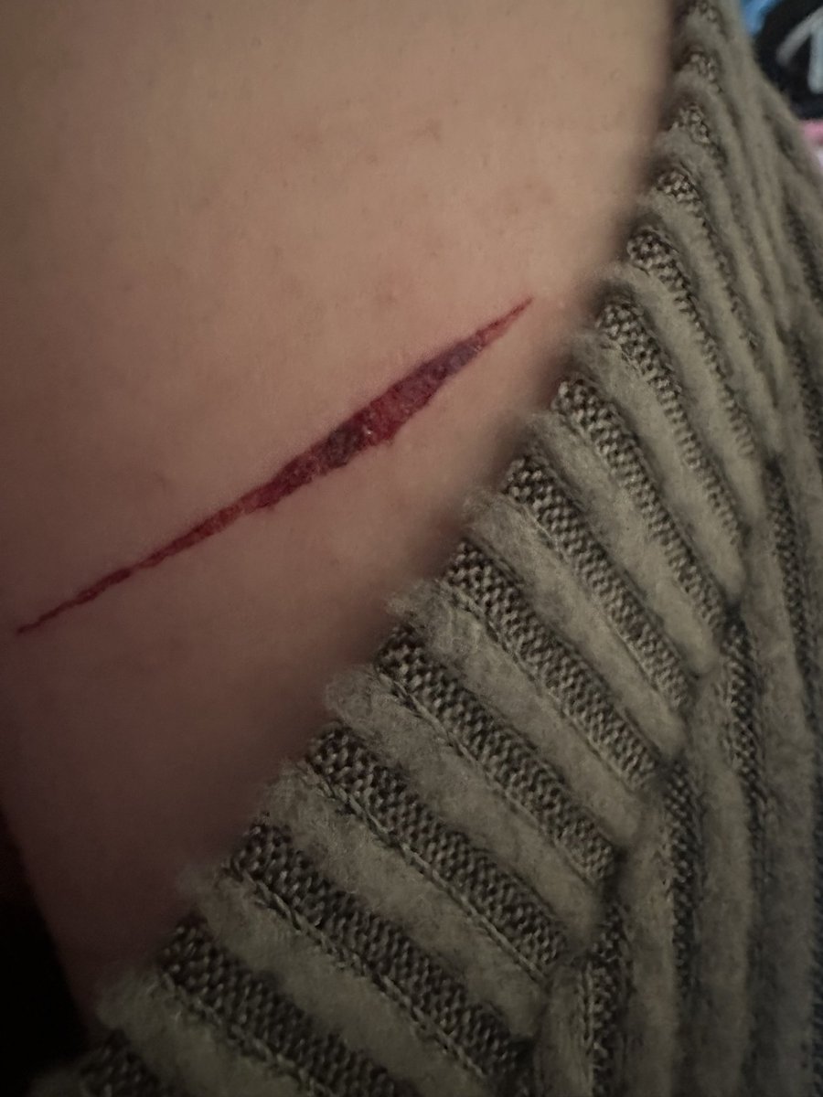 fayewebstrluvr's tweet photo. Stitches or no? Idk #shhtwt #shtwt https://t.co/ogRqI5jK0Z