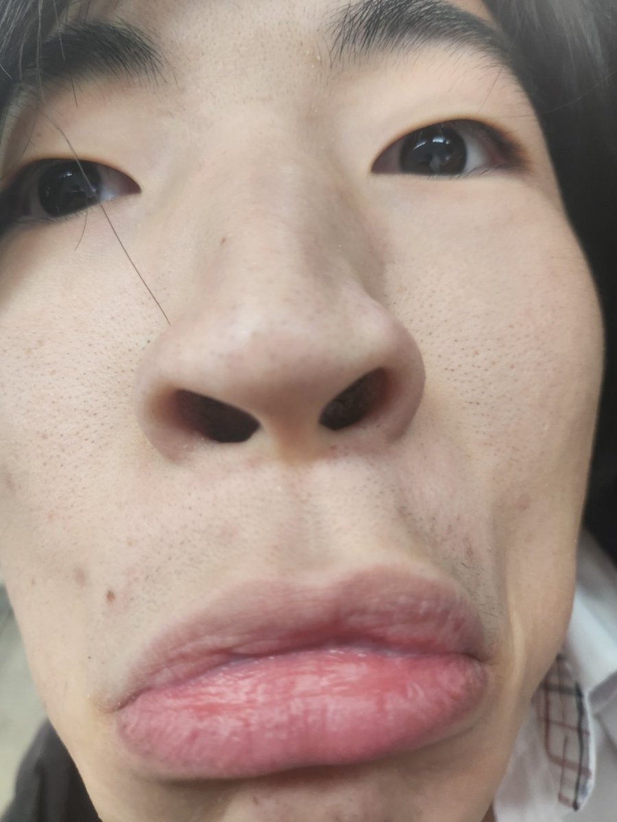 공백 tweet media
