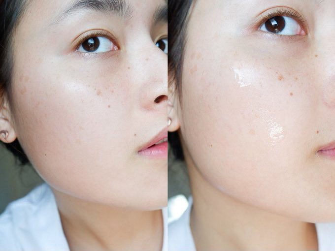 pimrypraew's tweet photo. 💥💥ไอเทมกู้ผิวใสที่แท้ทรู! Dark Spot Correcting Glow Serum (50 ml) เซรั่มเนื้อบางเบา ซึมไว ไม่เหนอะหนะ อัดแน่นด้วยสารสกัดที่ช่วยบล็อกเม็ดสีเมลานิน ปรับสีผิวให้สม่ำเสมอ ลดเลือนจุดด่างดำได้อย่างตรงจุด พร้อมเติมความชุ่มชื้นให้ผิวดูโกลว์ อิ่มน้ำ สุขภาพดี ผิวแพ้ง่ายก็ใช้ได้นะดีงามสุดๆ 🩷📌 โปรโมชั่นตอนนี้ จาก 990 บาท เหลือ 599 บาทด้วย ไปตำกันน