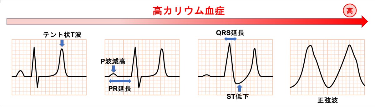 心電図.com tweet media