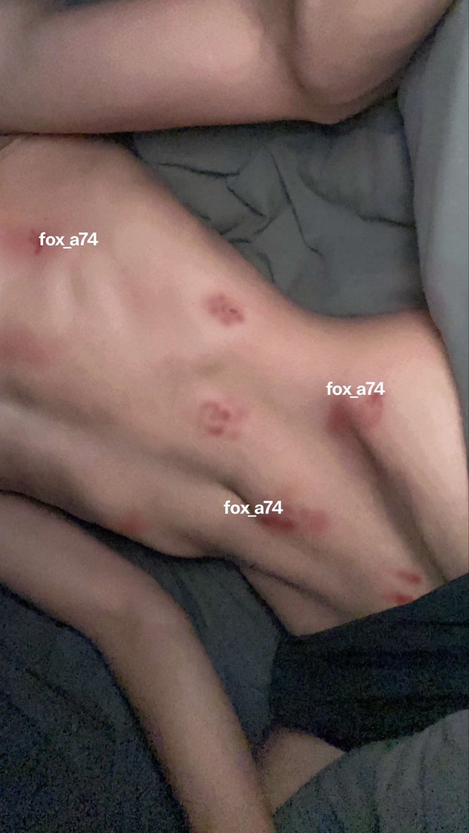 fox_22i's tweet photo. طحت في واحد مشفوح اول مره يشوف جسم كذا يعني ولا وش 🙄
نحيف تعال بصورك 🧑🏼‍🦯
#سالب_الدمام #موجب_الدمام https://t.co/J1ucON6rS0