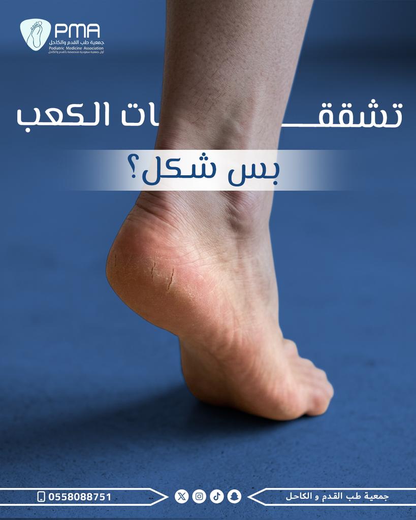PMAssoc_SA's tweet photo. لا⚠️
ممكن تتحول لجروح مؤلمة إذا أهملتها.
الترطيب اليومي ضروري. https://t.co/hrjnGCUnLu