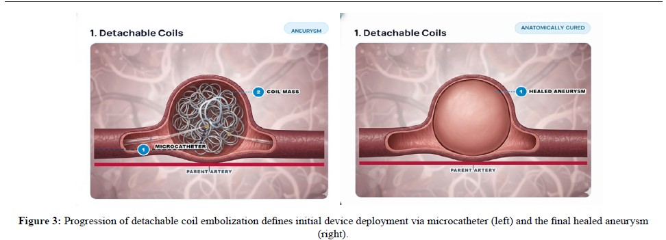 HealthTechJour1's tweet photo. From #Emergency care to #AI-powered precision therapy, #embolization is transforming minimally invasive medicine.
It highlights advanced embolic materials, smart biomaterials, ##catheter technologies, 3D printing,image guided treatments etc., 
Explore: https://t.co/jY2yg1DDaR https://t.co/lC61YvyBPK