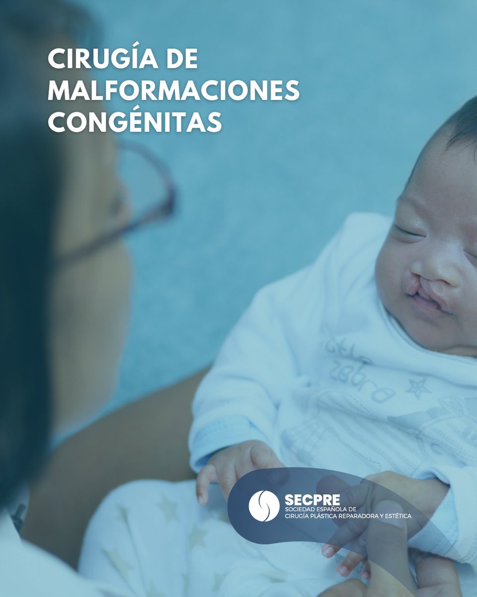 SECPREorg's tweet photo. La cirugía plástica es fundamental en malformaciones congénitas, como labio leporino y fisura palatina, mejorando función y desarrollo.

El enfoque personalizado y seguimiento continuo son claves para el bienestar físico y emocional.

#SECPRE #CirugíaPlástica #SaludInfantil https://t.co/KzVz1R9fxX