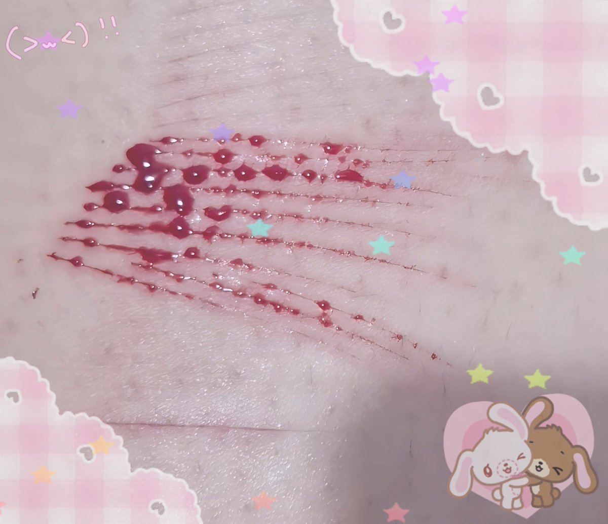 恵 tweet media