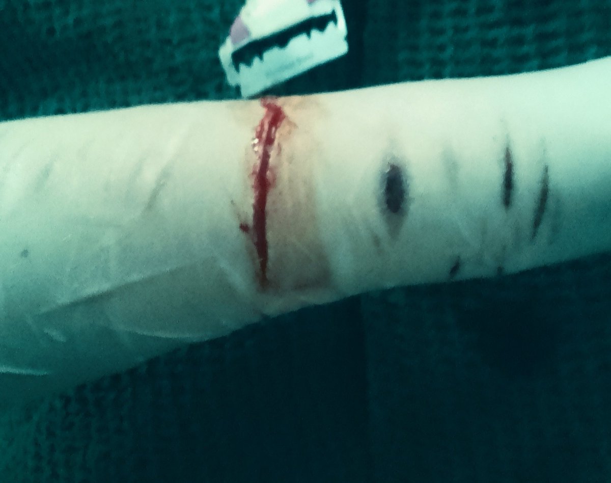 blooper74656's tweet photo. Taken yuuu.... Two days ago , I just forgot to post 😠
#fakeall #fakeblood #shtwt #shtなりきりさんがrtしてくれてそれを見たshtなりきりさんがきっとフォローしてくれる https://t.co/E6vjIzSaqn