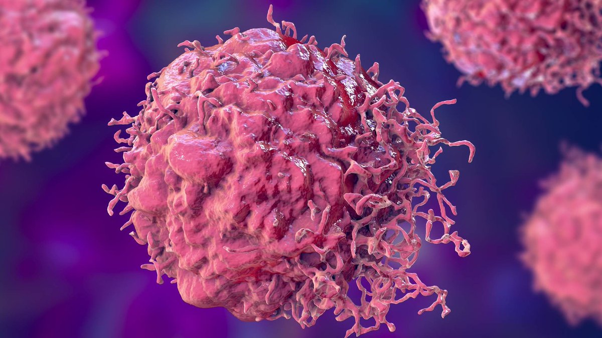 aaronboyde2001's tweet photo. Chinese scientists build handheld cancer detector with 94.9% accuracy in trials     #Medicine   #Health   #Tech https://t.co/uSCGxC47NA https://t.co/rsgnV9rvbk