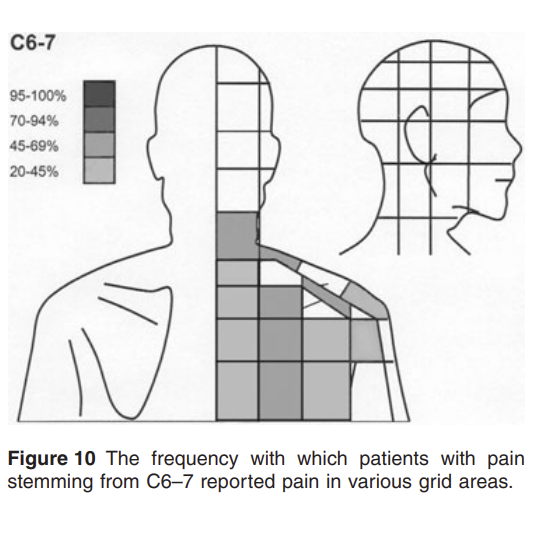 LSaugman's tweet photo. @DerekGriffin86 Very often seen clinically. I wonder how referred pain from C6-7 can refer so low into the scapula (Here Bogduk paper). Which sensory nerves travel that far distal or is it sclerotomal referral ? https://t.co/y56Ryir0N5