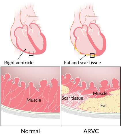 CardiovascularCorner tweet media