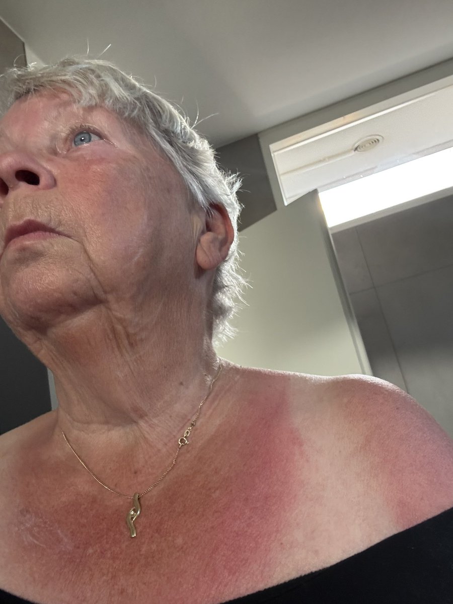 Dianne Lamers🐦🎗️ katten: Kaatje en Siepie tweet media