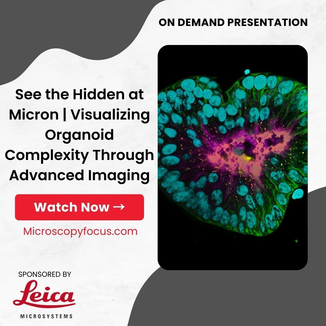 BitesizeBio's tweet photo. Explore how organoids and human-relevant models are advancing research into cancer, neurodegeneration, and more. Learn about next-gen imaging technologies and spatial tools from the experts, in this hybrid event recording. Watch On Demand → https://t.co/wGXpPzpttu #NAMs #NATs https://t.co/7wCrZQgv3A