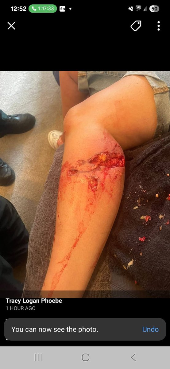 Wagerr_Man's tweet photo. @WestYorksPolice you wont even visit my friend to take a statement after she was attacked by a dog and left  needing surgery because there was no cctv. https://t.co/UIPQGf7UdI