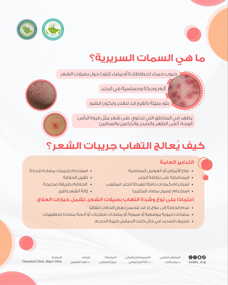 ssdds_org's tweet photo. التهاب جُريبات الشعر هو حالة جلدية شائعة تحدث نتيجة عدوى بكتيرية أو فطرية تُصيب بصيلة الشعر. يظهر على شكل بثور حمراء صغيرة أو بثور بيضاء تشبه حب الشباب حول الشعرة، وقد يصاحبها حكة، أو ألم، أو احمرار. 
تعرّفوا على المزيد من خلال هذا الإنفوجرافيك 🔎
#ssdds_infographic https://t.co/YuBzwgG92J