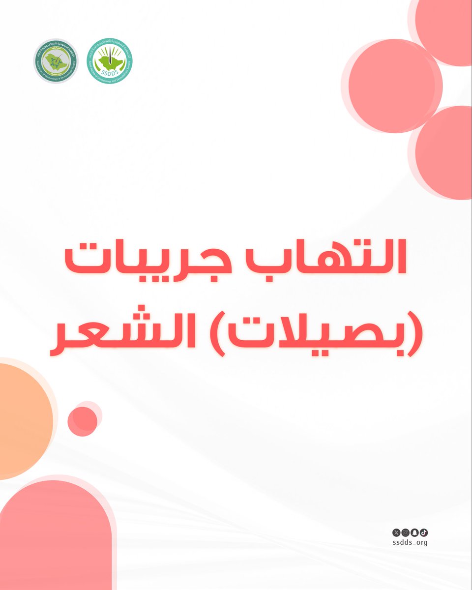 ssdds_org's tweet photo. التهاب جُريبات الشعر هو حالة جلدية شائعة تحدث نتيجة عدوى بكتيرية أو فطرية تُصيب بصيلة الشعر. يظهر على شكل بثور حمراء صغيرة أو بثور بيضاء تشبه حب الشباب حول الشعرة، وقد يصاحبها حكة، أو ألم، أو احمرار. 
تعرّفوا على المزيد من خلال هذا الإنفوجرافيك 🔎
#ssdds_infographic https://t.co/YuBzwgG92J