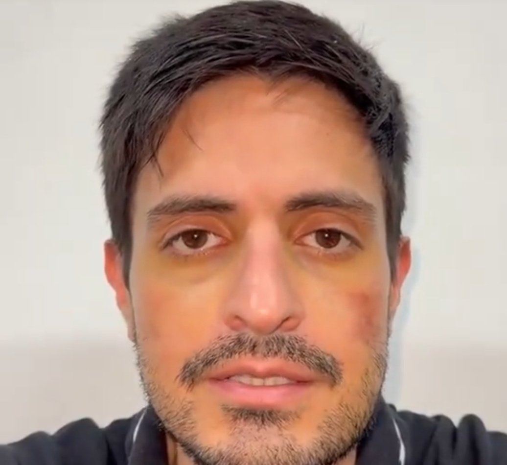 Papuyo🇻🇪 tweet media