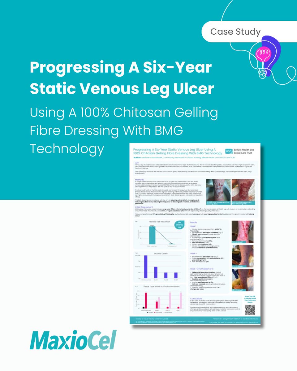 CDMedical's tweet photo. This recently-published case study evaluates MaxioCel 100% chitosan gelling fibre dressings in a patient with a venous leg ulcer, present for 6 years.

https://t.co/ZjRsrw0fNe https://t.co/eE7pd0Utj0