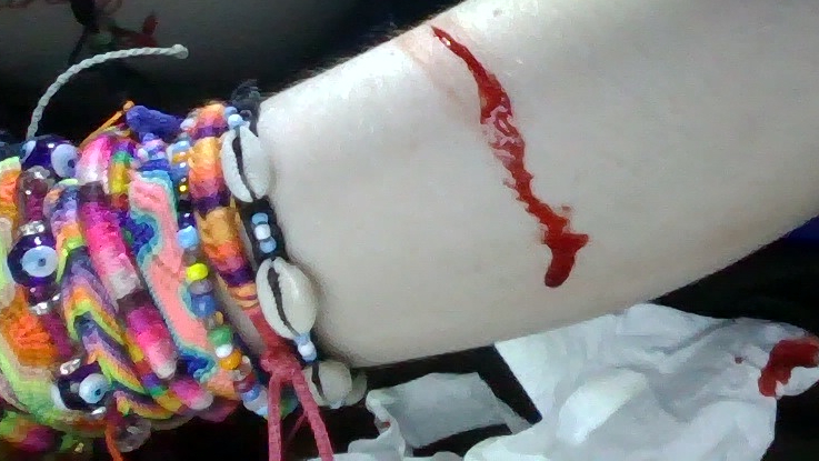 necrokitty420's tweet photo. fake blood fake cuts #slitwt #cutspo #beanspo #styrospo #styrotwt #shedtwt #shtwt #fakebody #seshy #drugtwt #bpdtwt #multiswipe #sledtwt https://t.co/2aUkbGD40X