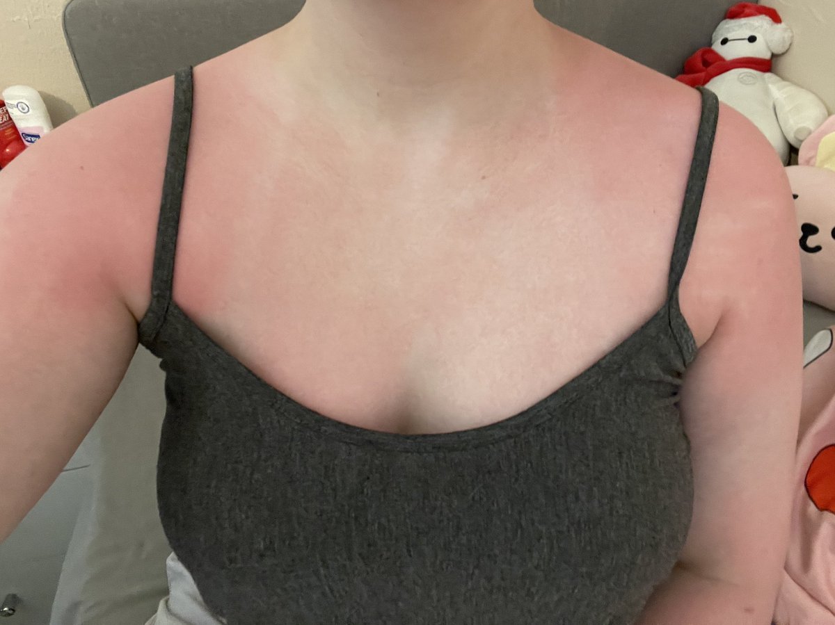 SOOBINDREAMING_'s tweet photo. Got back from the beach and y’all im gonna cry this shit hurts 😂😭 https://t.co/YihZ4dsoAZ